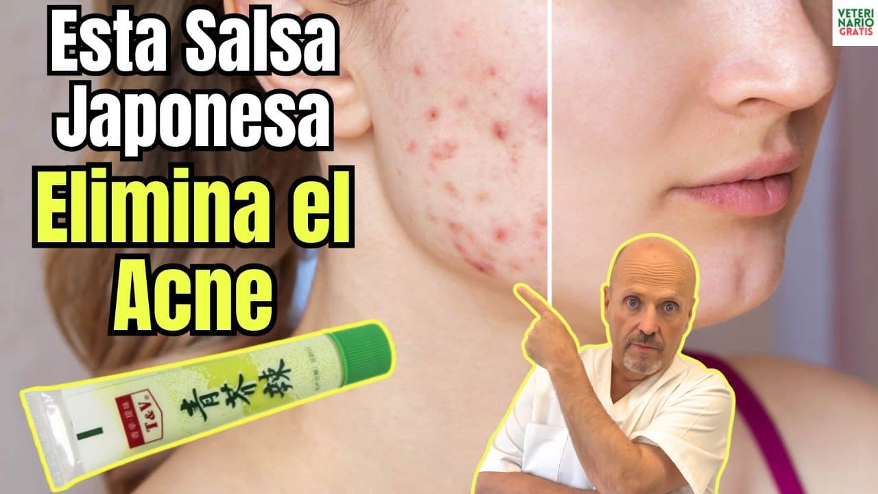 Como eliminar el acne en la piel con wasabi